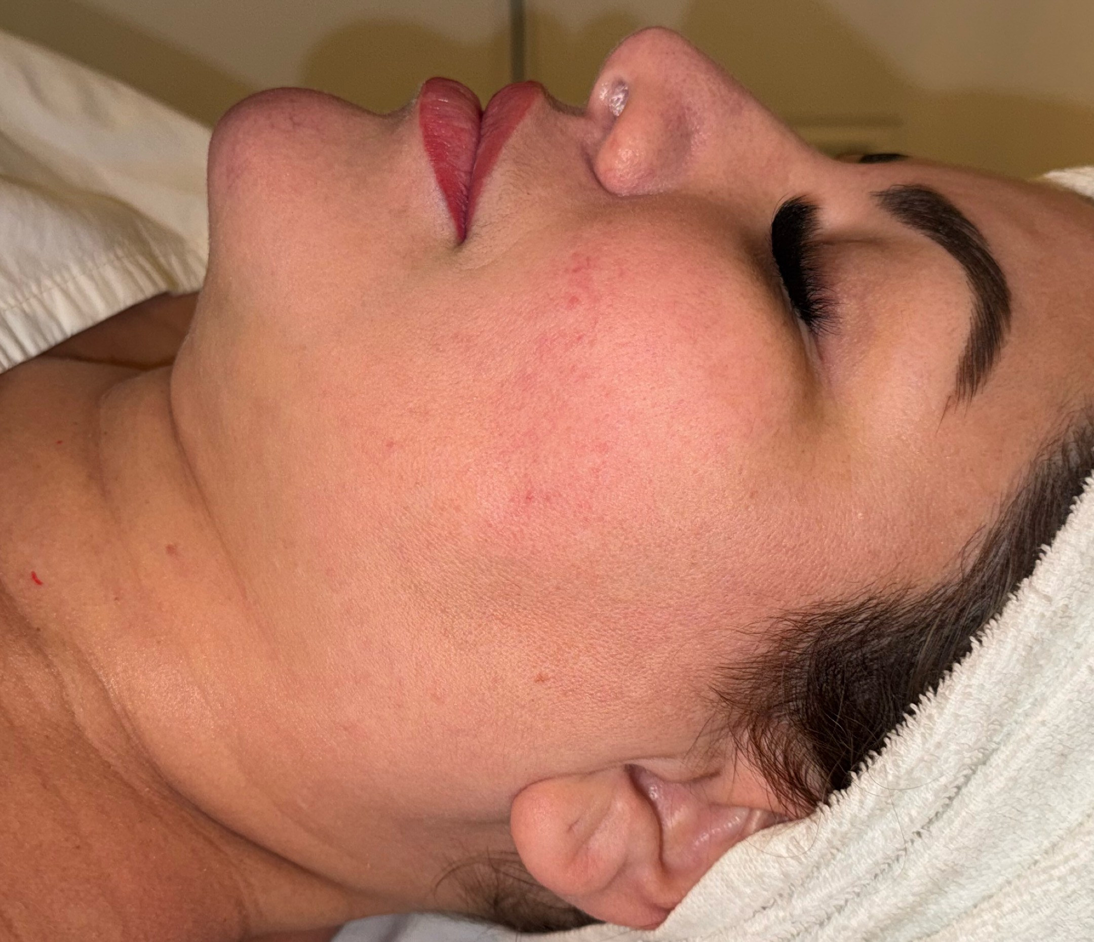 Antes – Miracle Touch